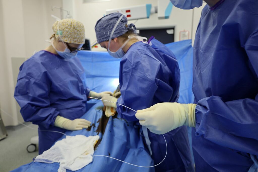 Laser_chirurgie_digestive_kyste_pylonidal_Centre_Hospitalier_Tourcoing